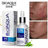 Сироватка від акне Bioaqua Pure Skin Acne Brightening & Best Solution (30мл), фото 2