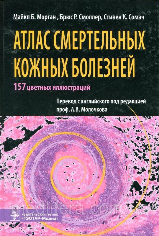 Морган М. Б., Сомач С. К., Смоллер Б. Р. Атлас смертельних шкірних хвороб