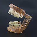 Демонстраційна модель брекетів для ортодонтів, фото 5
