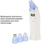 Вакуумний очисник пор обличчя Doc-team Spa прилад для чищення пор від чорних цяток, акне, вугрів із 4 насадками, фото 3