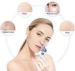 Вакуумний очисник пор обличчя Doc-team Spa прилад для чищення пор від чорних цяток, акне, вугрів із 4 насадками, фото 5