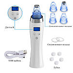 Вакуумний очисник пор обличчя Doc-team Spa прилад для чищення пор від чорних цяток, акне, вугрів із 4 насадками, фото 6