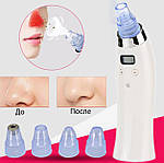 Вакуумний очисник пор обличчя Doc-team Spa прилад для чищення пор від чорних цяток, акне, вугрів із 4 насадками, фото 9