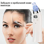 Вакуумний очисник пор обличчя Doc-team Spa прилад для чищення пор від чорних цяток, акне, вугрів із 4 насадками, фото 8