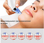 Вакуумний очисник пор обличчя Doc-team Spa прилад для чищення пор від чорних цяток, акне, вугрів із 4 насадками, фото 7