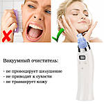 Вакуумний очисник пор обличчя Doc-team Spa прилад для чищення пор від чорних цяток, акне, вугрів із 4 насадками, фото 4