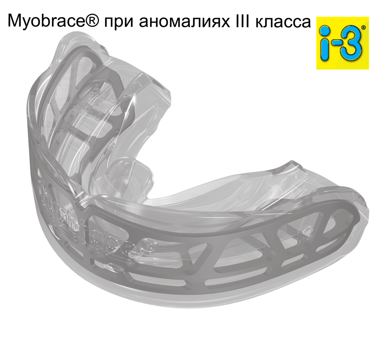 Трейнер Myobrace при аномаліях III класу I-3 large