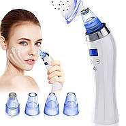 Що таке вакуумний очищувач пір і як його вибрати?