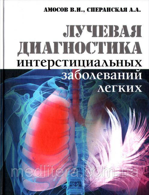 Амосов в. І. Променева діагностика інтерстиціальних захворювань легень 2015