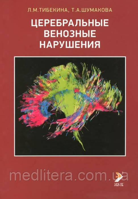 Тибекина Л. М. Церебральні венозні порушення, фото 1