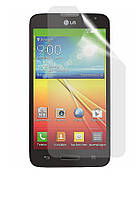 Матовая защитная пленка для LG Optimus L70 D320