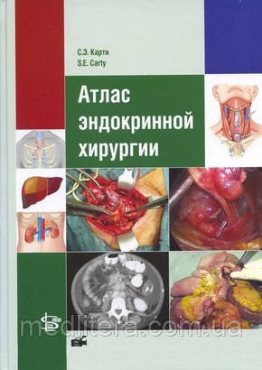 Селлі Е. Карти Атлас ендокринної хірургії