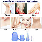 Силіконові банки для вакуумного масажу обличчя і тіла, фото 4