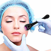 Мезоролер Derma Roller для обличчя на 0.3 мм, 540 голок, фото 2