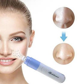 Вакуумний очищувач пір Facial Pore Cleaner для особи, від чорних крапок