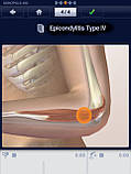 Endomed 482 — фізіотерапевтичний апарат для електротерапії, фото 4