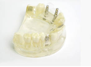 Демонстраційна модель для імплантології