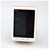 Апекслокатор Woodpecker Woodpex III Golden (Золотий), фото 2