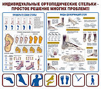 Баннер степени плоскостопия и строение стопы 1050х1200 мм