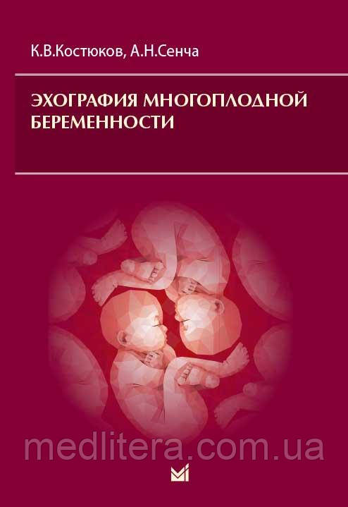 Костюков К., Сенча А. Н. Ехографія багатоплідної вагітності 2019 рік
