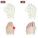 Силіконові роздільники Коректор для пальців ніг  (ZVR), фото 2