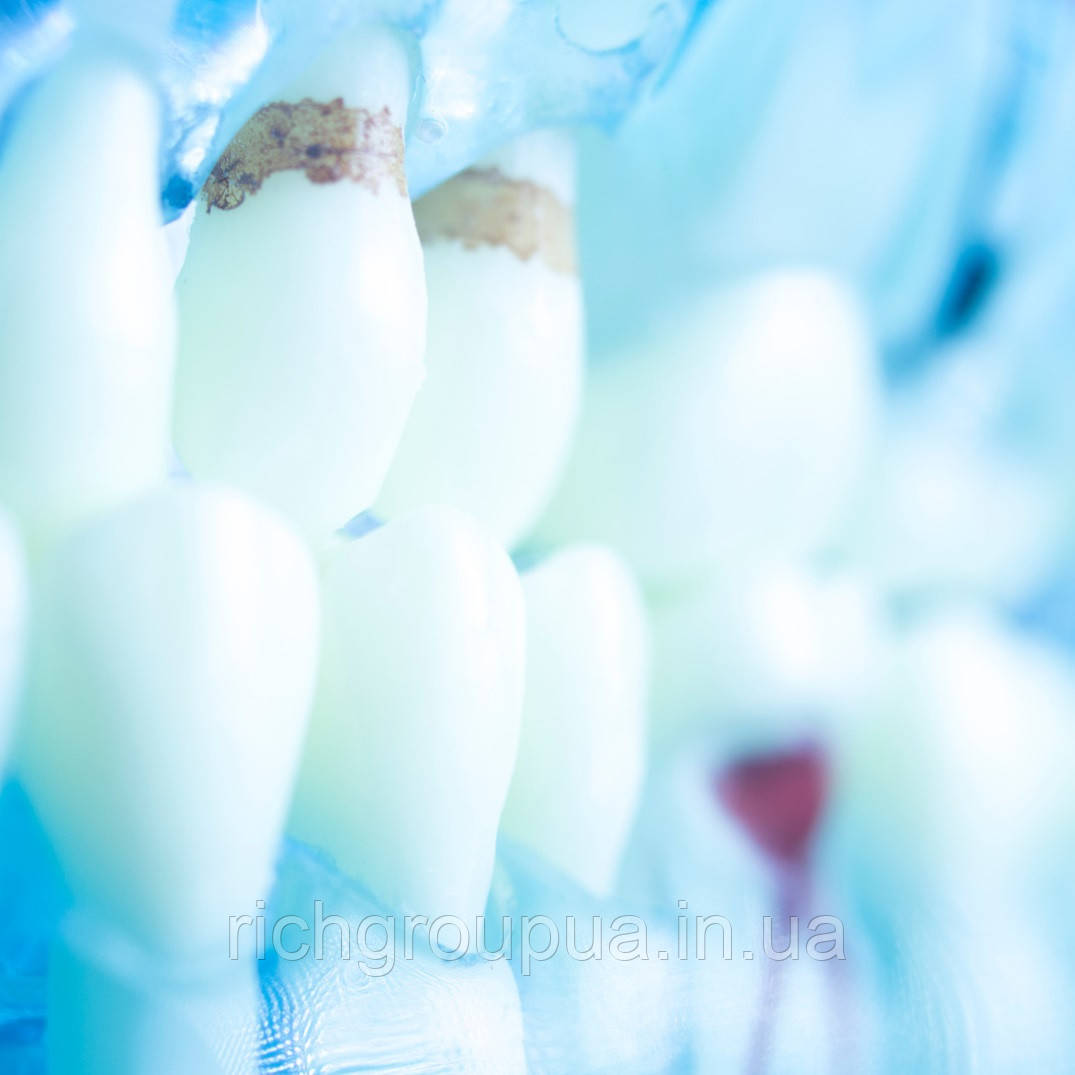 Отбеливающий гель для зубов УНИСЕПТ (гель для полости рта после операций и имплантации UNISEPT Oral gel 30г) - фото 5 - id-p1146343370