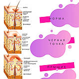 Крем проти акне (вуглеців, прищів, фарбувань, запалень, гнійників, плям постакне) Акнофікс®, фото 4