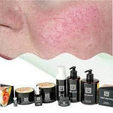 Інтенсивно зволожуючий живильний крем для чутливої шкіри та капілярів APRICOT» 50мл, фото 2