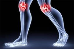 Колаген при артрозі