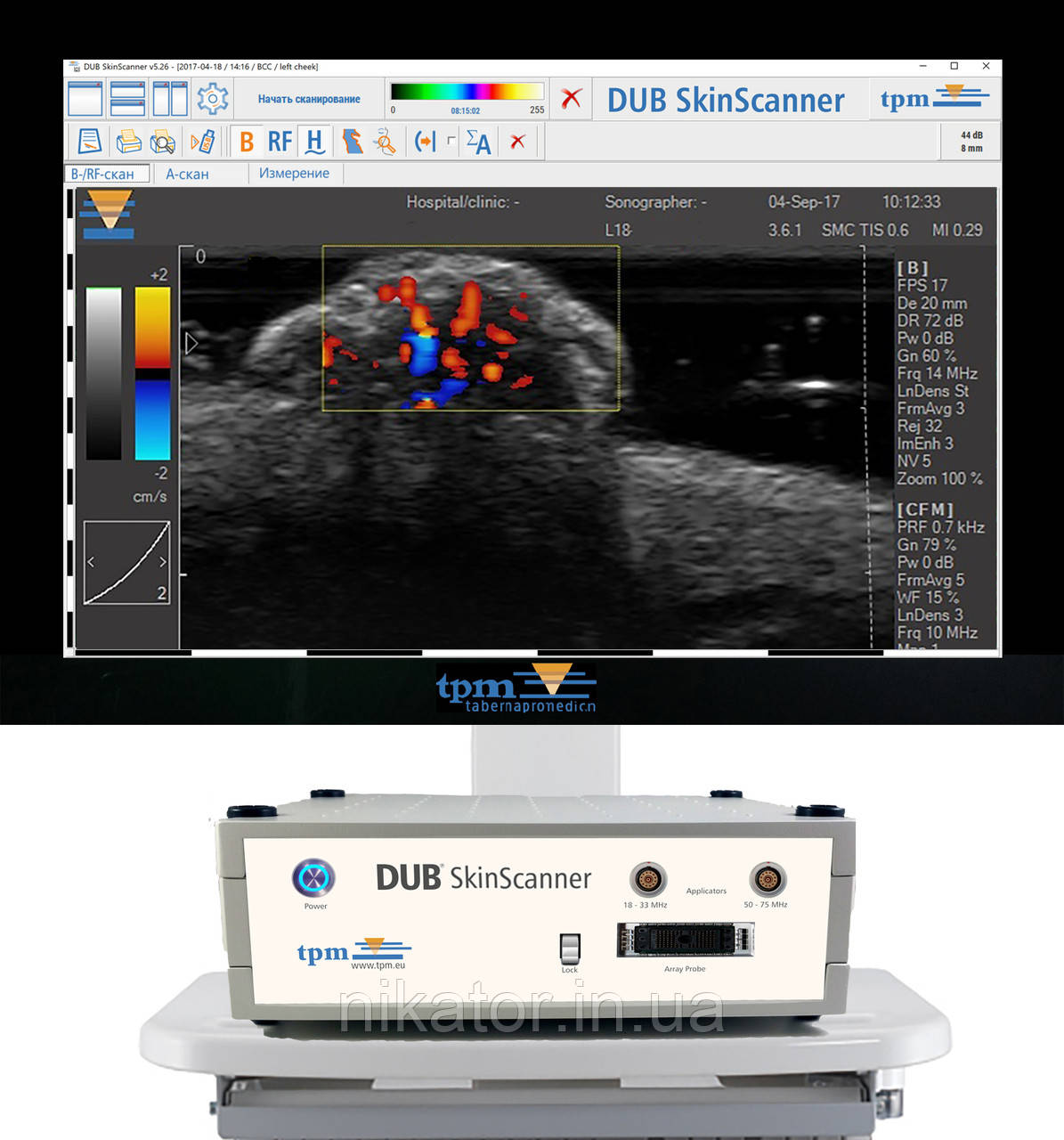 ПЗ апарат для шкіри Skinscanner з доплерографією
