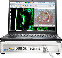 Ультразвуковий сканер для шкіри Dub SkinScanner (22-50)