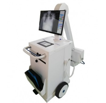 Рентгенівська система цифрова Corsix DR