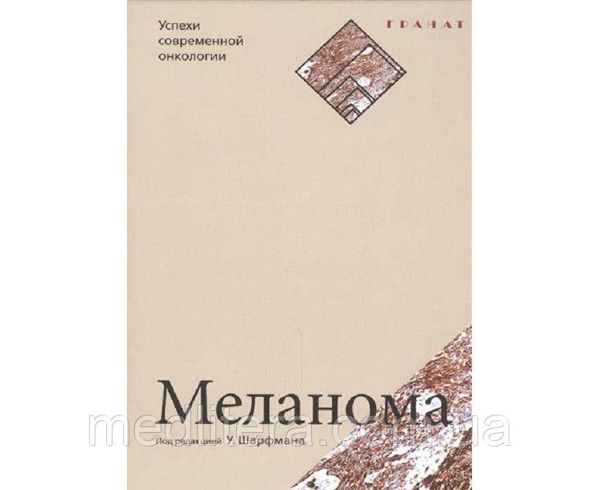 Шарфман У. Меланома