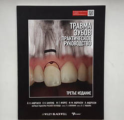 Книга "Травма зубів"