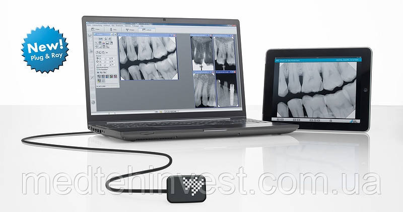 Радіовізіограф цифровий VistaRay 7 (Durr Dental), фото 1