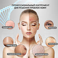 Ультразвуковий скрабер для чистки обличчя - портативний апарат для ультразвукової чистки лиця, пілінгу уз скрабер з LED-дисплеєм, фото 7