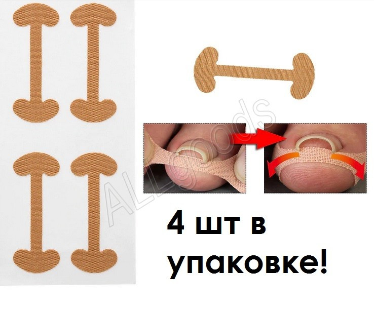 Наклейки від вростання нігтя 4 шт /уп, фото 1