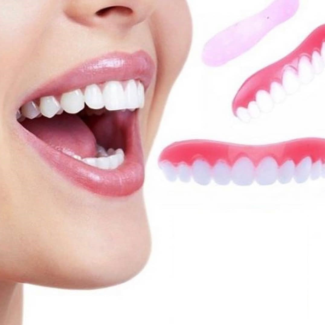Вініри для зубів perfect smile veneer