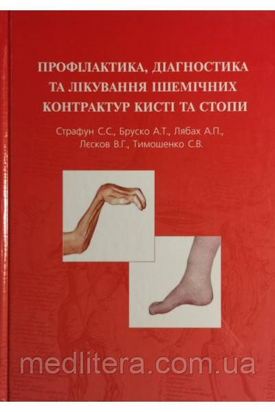 Страфун С. С. Профілактика, діагностика та лікування ішемічних контрактур кисті та стопи