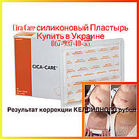 Cica Care 12x15 см Силіконовий пластир для лікування шрамів і рубців, зокрема келоїдних.