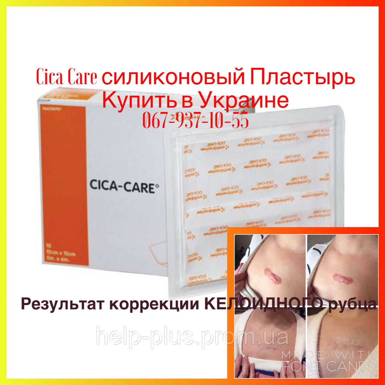 Cica Care 12x15см Силиконовый пластырь для лечения шрамов и рубцов в том числе келоидных. - фото 1 - id-p578039403