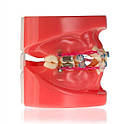 Модель зубів для демонстрації ортодонтичної патології, фото 3