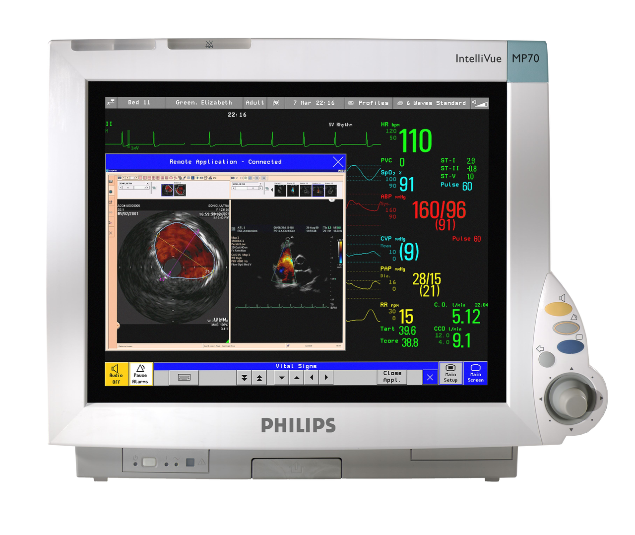 Монітор пацієнта PHILIPS IntelliVue MP70