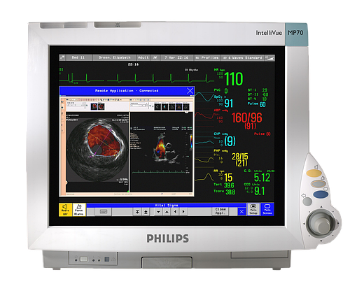 Монітор пацієнта PHILIPS IntelliVue MP70, фото 1