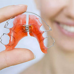 Для чого потрібен ретейнер і як він працює