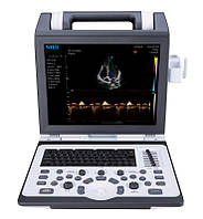 Ультразвукова діагностична система CTS-8800