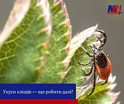 Укуси кліщів - що робити далі?