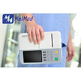 Електрокардіограф 3/12 канальний BeneHeart R3, фото 3