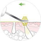 Мікромасаж і фонофорез Мікромасаж і фонофорез