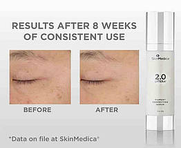 Антивікова сироватка SkinMedica Lytera 2.0 Pigment Correcting Serum Facial Serum 60ml, фото 2